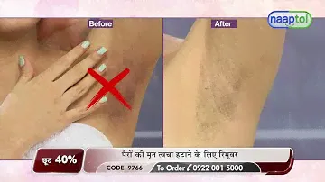Dead Skin Remover  -LPO (Code: 9766) SHORT VIDEO  24474